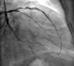 Kardiologische Funktionsdiagnostik