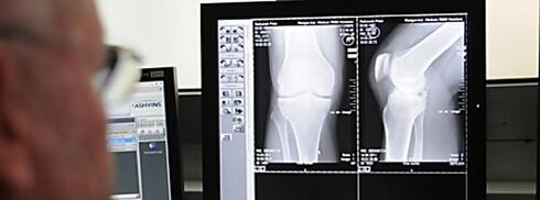 Röntgenbild in der Unfallchirurgie