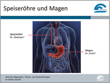 Abb.1: Anatomische Darstellung von Speiseröhre und Magen