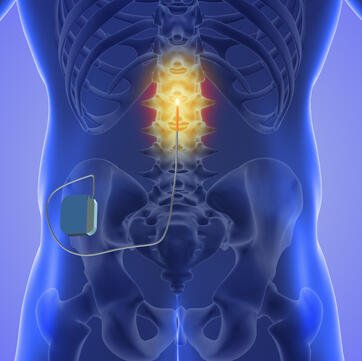 Funktionelle Neurochirurgie (Bild: Shutterstock)