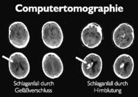 Computertomographie